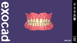 exocad Video Tutorial Full Denture Design [upl. by Ecnerrat]