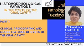 Variations in Cysts of the Oral Cavity part 1 Oral Pathology 360 Fundamantals [upl. by Eneleahs265]