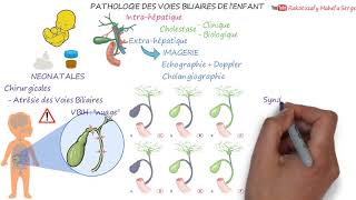 PATHOLOGIE DES VOIES BILIAIRES DE l’ENFANT [upl. by Ahsenyl]