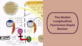 Medial Longitudinal Fasciculus Rapid Review [upl. by Stetson]