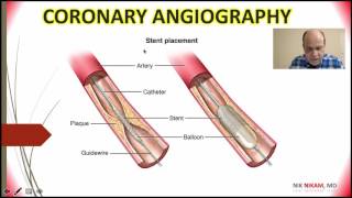 CORONARY ANGIOGRAPHY 101 NIK NIKAM MD [upl. by Simmons]