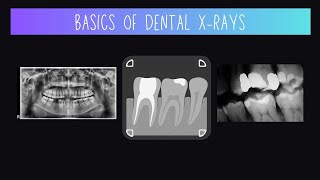 Basics of Dental Xrays [upl. by Elish467]