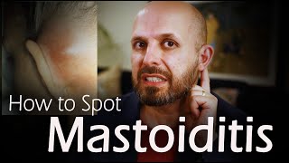 Do I have Mastoiditis Bone Infection behind the Ear [upl. by Analim]