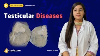 Testicular Diseases  Pathology Lectures  Medical Education Made Easy  VLearning [upl. by Valene252]