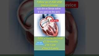 when do Echo after asd device closure l echo asd shorts [upl. by Cherice]