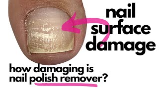 How Damaging Is Nail Polish RemoverAcetone Surprise Surprise [upl. by Elinet]