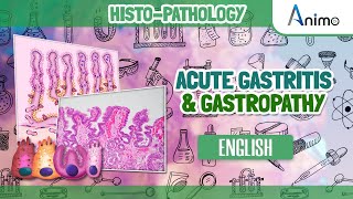 Acute Gastritis amp Gastropathy  Morphology  English [upl. by Trauner]