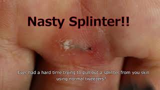 How to Remove a Splinter Nasty Sliver Removal Hack  DUROX Tweezers [upl. by Pasadis958]