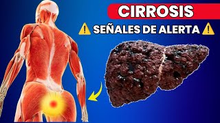 11 Señales Tempranas de Cirrosis Hepática que No Debes Ignorar [upl. by Culliton]