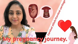 My pregnancy journey  Cervical cerclage Cervical stitch Surgery [upl. by Akienaj]