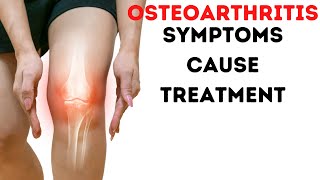 Osteoarthritis in Hindi  arthritis symptoms treatment cure [upl. by Ambur]