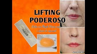 Incrível Lifting caseiro q acaba com Bigode Chinês rugas e marcas de expressão [upl. by Survance]