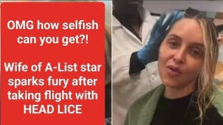 quotActress Jenny Mollen Sparks Outrage After Flying with Head Lice  Full Storyquot [upl. by Publus]