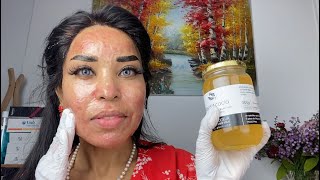 BIEN CICATRISER APRÈS LE MICRONEEDLING avec du miel [upl. by Burnham376]