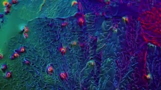 acetylsalicylic acid dissolving and crystallizing [upl. by Nyrehtac766]