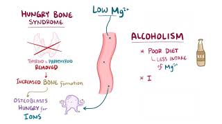 Hypomagnesemia causes symptoms diagnosis treatment pathology [upl. by Damalus]