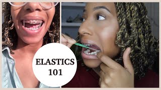 BRACES ELASTICSRUBBER BANDS 101  Everything You Need To Know [upl. by Leirraj]