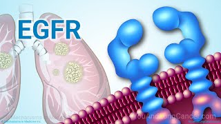 Understanding NSCLC Treatment When You Have an EGFR Mutation [upl. by Azial]