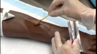 IV Therapy Venipuncture [upl. by Lunette]