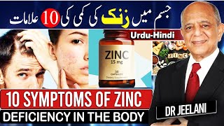 10 Symptoms of Zinc Deficiency in The Body II जिंक की कमी I جسم میں زنک کی کمی کی 10علامات drjeelani [upl. by Iramo]