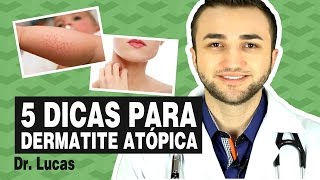 5 Dicas para Dermatite Atópica Alergia em crianças [upl. by Colly]