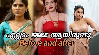 പ്ലാസ്റ്റിക് സർജറി ചെയ്ത നടിമാർ  actress who did plastic surgery malluactress youtubevideo [upl. by Tapes]