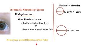 DISEASES OF CORNEA1CONGENITAL ANOMALIESUndergraduate OphthalmologyEasy LearningMedical ABC [upl. by Aneras]