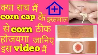 corn treatment in hindi [upl. by Alicirp218]