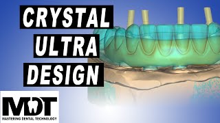 Exocad Crystal Ultra all on 4 bridge supra structure smile design [upl. by Standush]