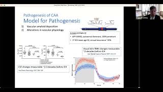 Cerebral Amyloid Angiopathy Dr Steven Greenberg MD PhD [upl. by Norrab730]