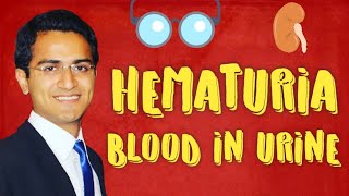 Hematuria Causes amp Diagnostic Workup of Blood in Urine [upl. by Grondin]