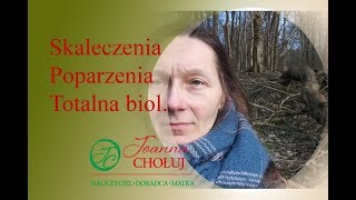 SkaleczeniaPoparzenia  totalna biologia OkiemMatkiSłowianki [upl. by Eninnaj938]