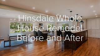 Before and After  Hinsdale Whole House Remodel [upl. by Norbel992]