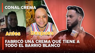 FABRICÓ UNA CREMA QUE TIENE A TODO EL BARRIO BLANCO  CONAL CREMA [upl. by Aldarcie]