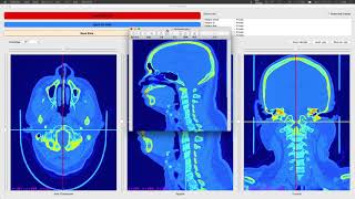 Dicom Viewer Project – 3D Processing Demo [upl. by Violet]