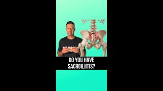 🔍 Suspecting Sacroiliitis 🔍 [upl. by Ahtelrac407]