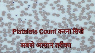 Platelet count under microscope  Platelets Count करना सिखे [upl. by Ecnirp966]