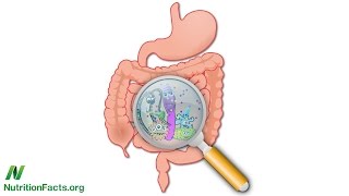 Bowel Wars Hydrogen Sulfide vs Butyrate [upl. by Megan]