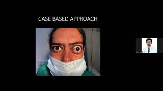 Evaluation of a case of Proptosis Exam approach for FRCS Ophthalmology [upl. by Eralcyram]