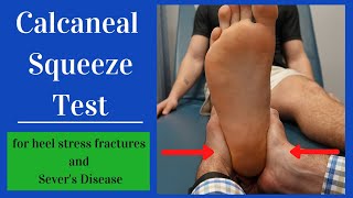 Calcaneal Squeeze Test Heel Squeeze [upl. by Sigfried]