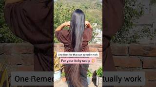 Scalp itching home remedy  Scalp itching treatment youtubeshorts [upl. by Ynner139]