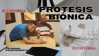 Las prótesis biónicas transforman vidas en Mompox [upl. by Nairam]