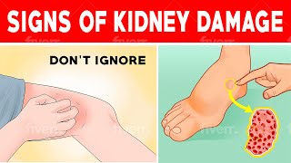 How to recognize Signs of Kidney Damage [upl. by Ainad312]