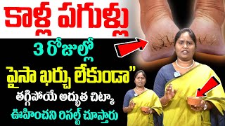 కాళ్ళ పగుళ్ళు చిటికెలో తగ్గాలంటే  Kaalla pagullu  How to Get Rid  Dr Shaguftha  iDream Health [upl. by Niloc178]