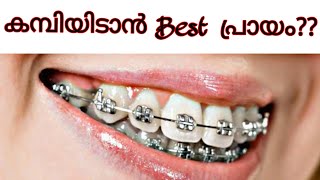 Best time for braces malayalam  braces  pallil kambi idunnath malayalam  pallil kambi [upl. by Aihsele]