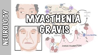 Myasthenia Gravis  symptoms pathophysiology investigations treatment [upl. by Nnalatsyrc]