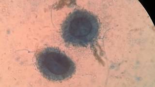 Sporangium and Sporangiospores [upl. by Carn]