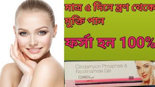 Clinsol gel use in bangla ফর্সা হন 100 Clinsol gel full review bangla [upl. by Attenyt]