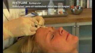 Restylane och Botox behandling [upl. by Endora]