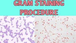 Gram staining procedure explained [upl. by Ahsile]